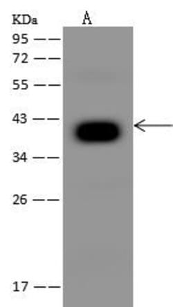 Invitrogen PDSS2 Polyclonal Antibody 100 &mu;L; Unconjugated:Antibodies,