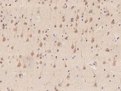 Invitrogen PHACTR3 Polyclonal Antibody 100 &mu;L; Unconjugated:Antibodies,