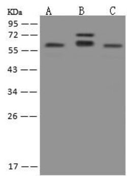 Invitrogen PHACTR3 Polyclonal Antibody 100 &mu;L; Unconjugated:Antibodies,