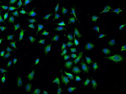 Invitrogen PKD2 Polyclonal Antibody 100 &mu;L; Unconjugated:Antibodies,