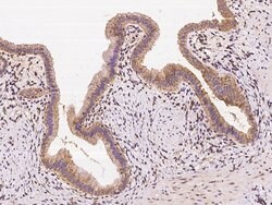 Invitrogen PKD2 Polyclonal Antibody 100 &mu;L; Unconjugated:Antibodies,