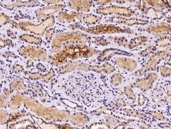 Invitrogen PKD2 Polyclonal Antibody 100 &mu;L; Unconjugated:Antibodies,