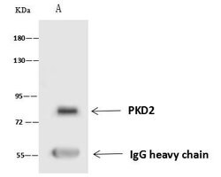 Invitrogen PKD2 Polyclonal Antibody 100 &mu;L; Unconjugated:Antibodies,