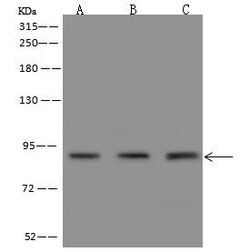 Invitrogen PKD2 Polyclonal Antibody 100 &mu;L; Unconjugated:Antibodies,