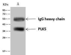 Invitrogen PLK5 Polyclonal Antibody 100 &mu;L | Buy Online | Invitrogen&trade; | Fisher Scientific