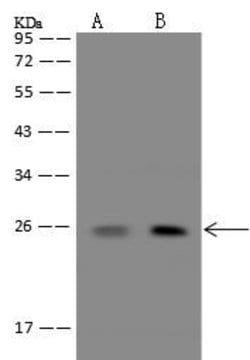 Invitrogen PPP1R27 Polyclonal Antibody 100 &mu;L; Unconjugated:Antibodies,