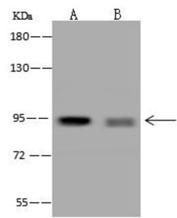 Invitrogen PPP1R3F Polyclonal Antibody 100 &mu;L; Unconjugated:Antibodies,