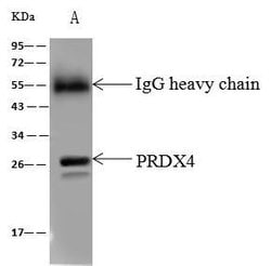 Invitrogen PRDX4 Polyclonal Antibody 100 &mu;L; Unconjugated:Antibodies,