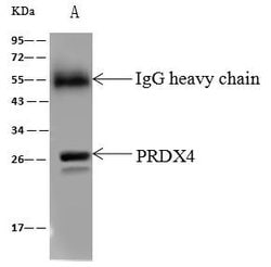 Invitrogen PRDX4 Polyclonal Antibody 100 &mu;L; Unconjugated:Antibodies,