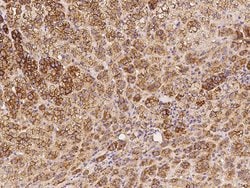Invitrogen PRKAR2B Polyclonal Antibody 100 &mu;L; Unconjugated:Antibodies,