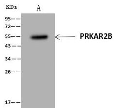 Invitrogen PRKAR2B Polyclonal Antibody 100 &mu;L; Unconjugated:Antibodies,