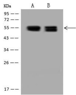 Invitrogen PRKAR2B Polyclonal Antibody 100 &mu;L; Unconjugated:Antibodies,