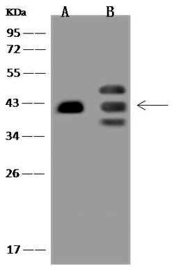 Invitrogen PRPF18 Polyclonal Antibody 100 &mu;L | Buy Online | Invitrogen&trade; | Fisher Scientific
