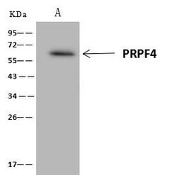 Invitrogen PRPF4 Polyclonal Antibody 100 &mu;L; Unconjugated:Antibodies,