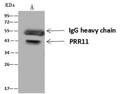 Invitrogen PRR11 Polyclonal Antibody 100 &mu;L; Unconjugated:Antibodies,