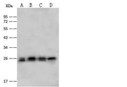Invitrogen PSMA2 Polyclonal Antibody 100 &mu;L; Unconjugated:Antibodies,