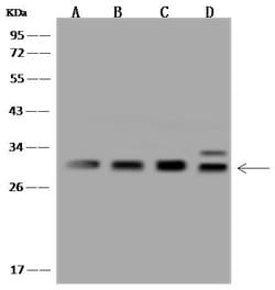 Invitrogen PSMA4 Polyclonal Antibody 100 &mu;L; Unconjugated:Antibodies,