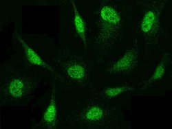 Invitrogen PSMB8 Polyclonal Antibody 100 &mu;L; Unconjugated:Antibodies,