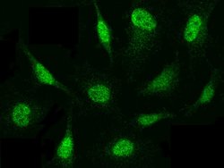 Invitrogen PSMB8 Polyclonal Antibody 100 &mu;L; Unconjugated:Antibodies,