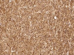 Invitrogen PSMB8 Polyclonal Antibody 100 &mu;L; Unconjugated:Antibodies,