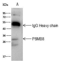Invitrogen PSMB8 Polyclonal Antibody 100 &mu;L; Unconjugated:Antibodies,