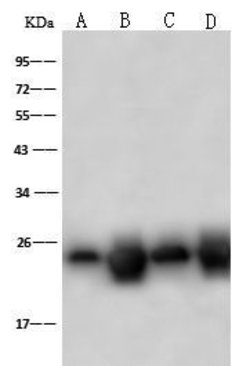 Invitrogen PSMB8 Polyclonal Antibody 100 &mu;L; Unconjugated:Antibodies,