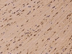 Invitrogen PSMC5 Polyclonal Antibody 100 &mu;L; Unconjugated:Antibodies,