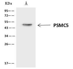 Invitrogen PSMC5 Polyclonal Antibody 100 &mu;L; Unconjugated:Antibodies,