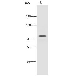 Invitrogen PSMD2 Polyclonal Antibody 100 &mu;L; Unconjugated:Antibodies,