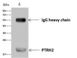 Invitrogen Bit1 Polyclonal Antibody 100 &mu;L; Unconjugated:Antibodies,