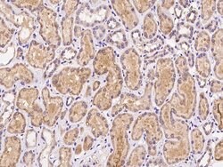 Invitrogen PXMP4 Polyclonal Antibody 100 &mu;L; Unconjugated:Antibodies,