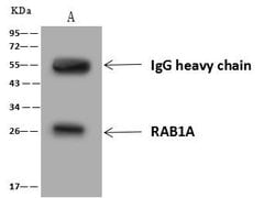 Invitrogen RAB1A Polyclonal Antibody 100 &mu;L; Unconjugated:Antibodies,