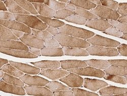 Invitrogen RAB7A Polyclonal Antibody 100 &mu;L; Unconjugated:Antibodies,