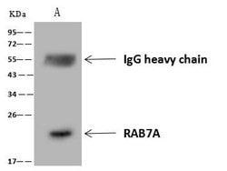 Invitrogen RAB7A Polyclonal Antibody 100 &mu;L; Unconjugated:Antibodies,