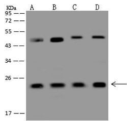 Invitrogen RAB7A Polyclonal Antibody 100 &mu;L; Unconjugated:Antibodies,