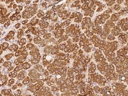 Invitrogen RAB9 Polyclonal Antibody 100 &mu;L | Buy Online | Invitrogen&trade; | Fisher Scientific