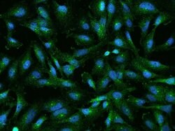 Invitrogen RABEP1 Polyclonal Antibody 100 &mu;L; Unconjugated:Antibodies,