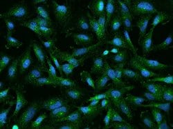 Invitrogen RABEP1 Polyclonal Antibody 100 &mu;L; Unconjugated:Antibodies,