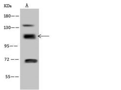 Invitrogen RABEP1 Polyclonal Antibody 100 &mu;L; Unconjugated:Antibodies,