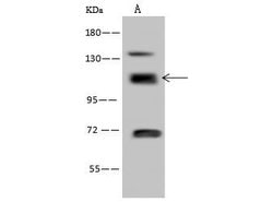 Invitrogen RABEP1 Polyclonal Antibody 100 &mu;L; Unconjugated:Antibodies,