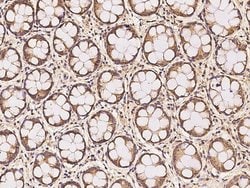 Invitrogen RDH14 Polyclonal Antibody 100 &mu;L; Unconjugated:Antibodies,