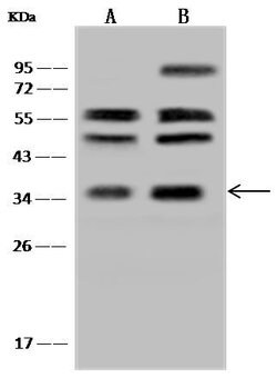 Invitrogen RDH14 Polyclonal Antibody 100 &mu;L; Unconjugated:Antibodies,