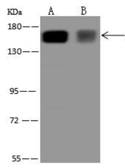 Invitrogen RPAP1 Polyclonal Antibody 100 &mu;L; Unconjugated:Antibodies,