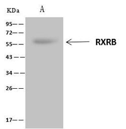Invitrogen RXRB Polyclonal Antibody 100 &mu;L; Unconjugated:Antibodies,
