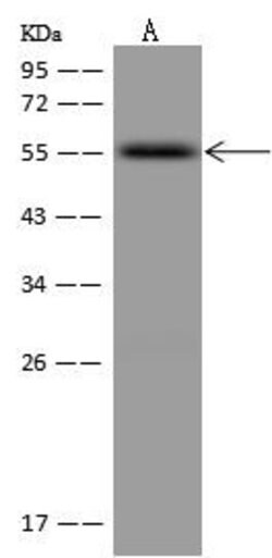 Invitrogen RXRB Polyclonal Antibody 100 &mu;L; Unconjugated:Antibodies,