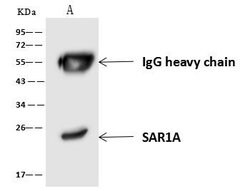Invitrogen SAR1A Polyclonal Antibody 100 &mu;L; Unconjugated:Antibodies,