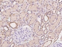 Invitrogen ACN9 Polyclonal Antibody 100 &mu;L; Unconjugated:Antibodies,
