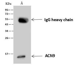 Invitrogen ACN9 Polyclonal Antibody 100 &mu;L; Unconjugated:Antibodies,