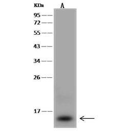 Invitrogen ACN9 Polyclonal Antibody 100 &mu;L; Unconjugated:Antibodies,