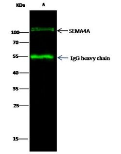 SEMA4A Polyclonal Antibody:Antibodies, Polyclonal